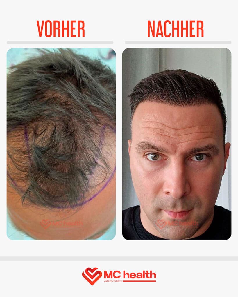 MC Health Turkey clinic